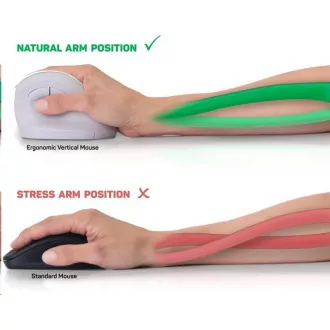 CONNECT IT FOR HEALTH ergonomická vertikálna myš, (+ 1x AA batéria zadarmo), bezdrôtová, červená CONNECT IT FOR HEALTH ergonomická vertikálna myš, (+ 1x AA batéria zadarmo), bezdrôtová, červená